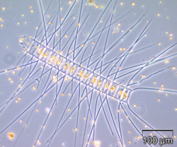 Phytoplankton-Chaetoceros_decipiens_IOW-Wasmund.jpg