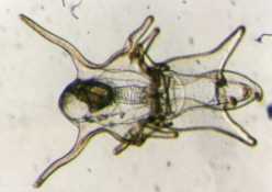 Zooplankton-Seesternlarve-BSH-Reiners.jpg